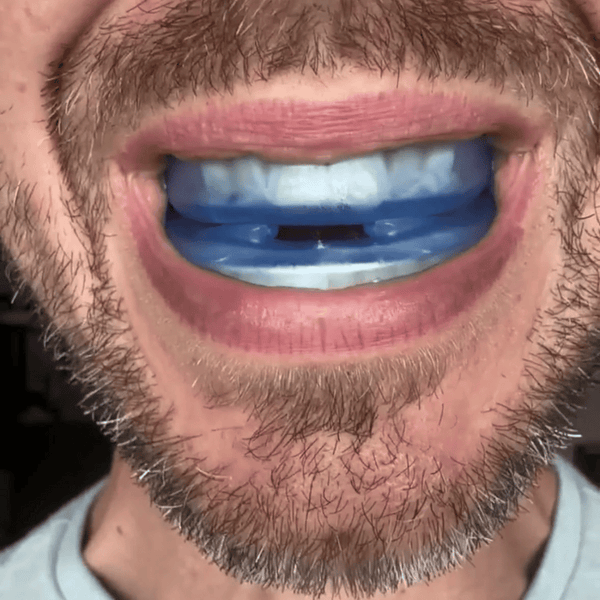 Mein Gesund™ Anti-Schnarch Mundstück