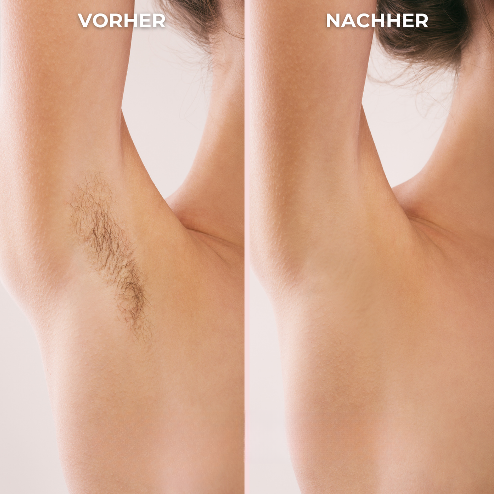 BikiniTrimmer™ Haarschneider - weil deine Haut nur das Beste verdient.