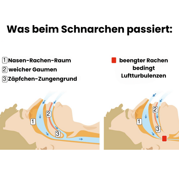 Mein Gesund™ Anti-Schnarch Mundstück